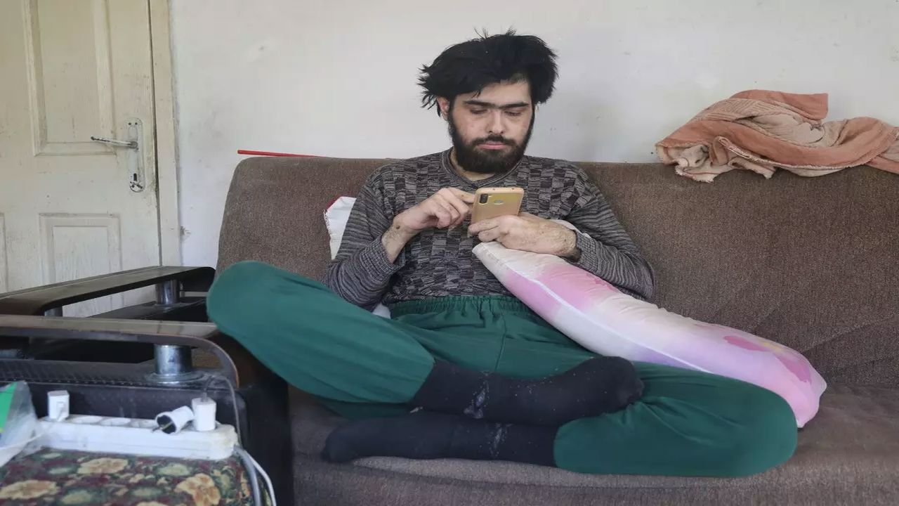 3 Yıl Sonra İlk Kez Dışarı Çıktı! Hataylı Gencin Değişimi Herkesi Şaşırttı